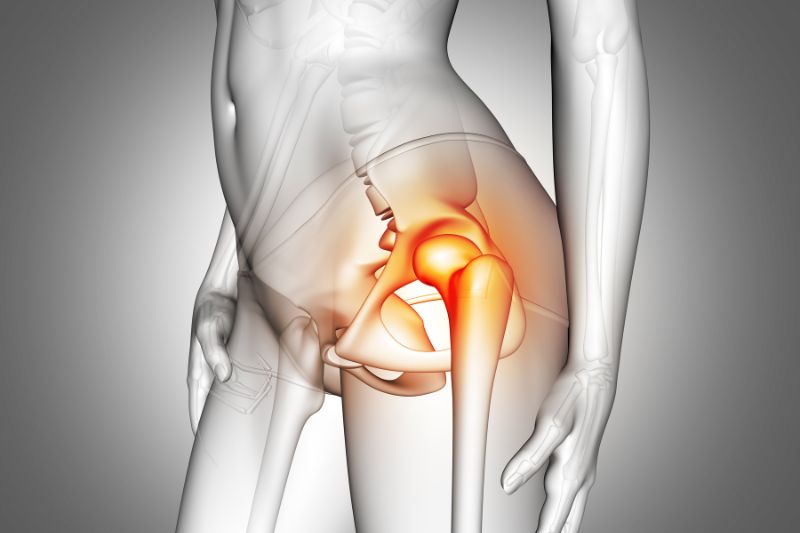 https://www.beverlyhillsmagazine.com/wp-content/uploads/Beverly-Hills-Magazine-Beyond-the-Surface-Exploring-Deep-Tissue-Causes-of-Hip-Pain-min.jpg